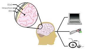 Brain-Computer Interfaces (BCIs)